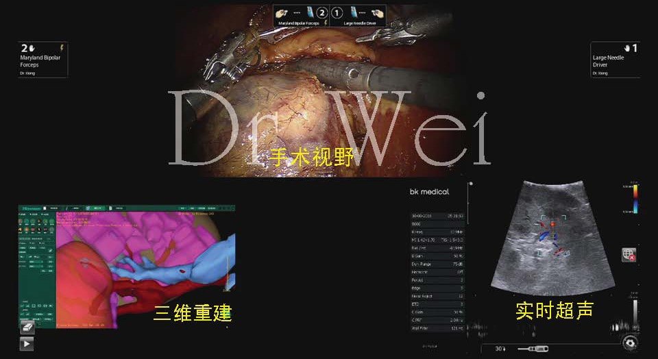 12月实时三维腔内彩超，科技重塑医疗体验，智能诊疗新时代的开启