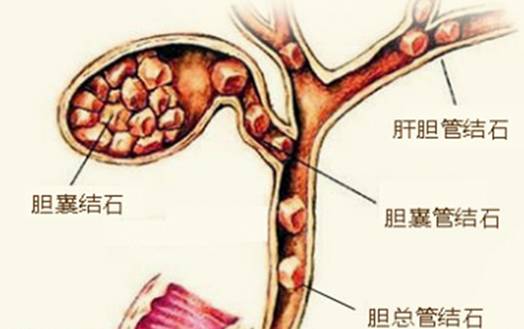 中上腹突发绞痛，突发中上腹疼痛 