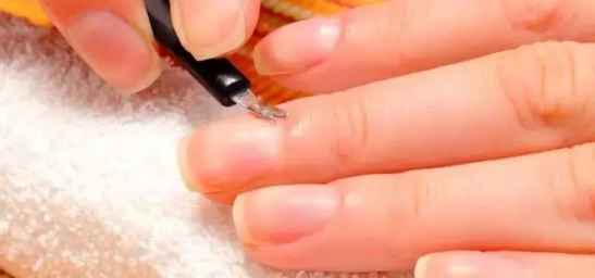 手部脱皮开裂揭秘，成因、应对方案与日常护理技巧