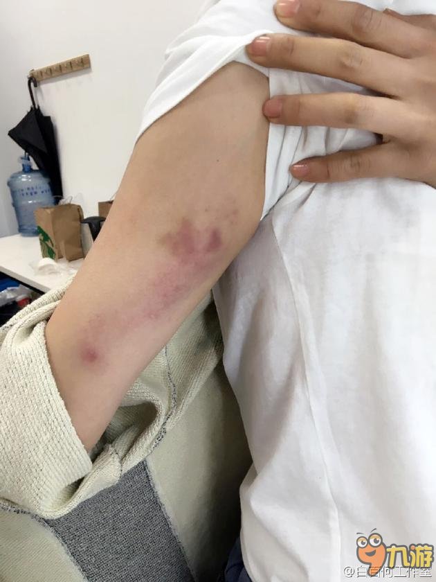 手臂突发受伤视频，手臂受伤了该怎么办 