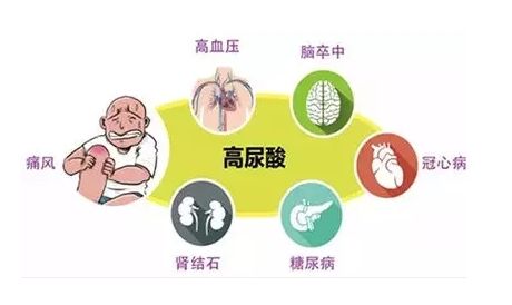 日本痛风病高发背后的原因与应对策略解析