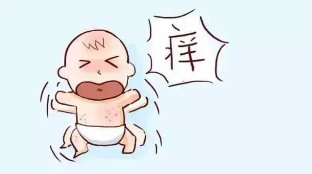 小儿湿疹全方位解读及应对攻略